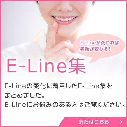 E-Line集